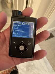 Medtronic 670g insulin pump held in hand, hybrid closed loop insulin pump with color screen
