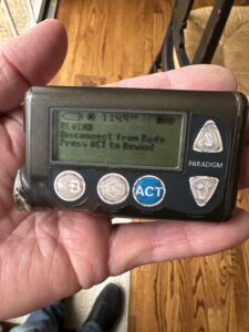 Medtronic Paradigm 522 insulin pump held in hand, gray insulin pump with LCD screen and control buttons